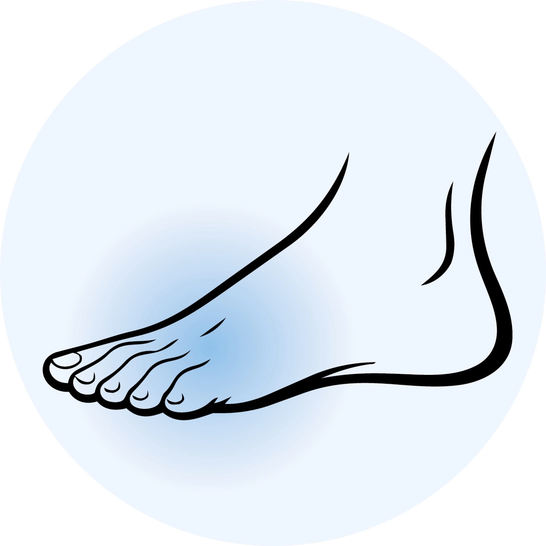 Shoes for hammertoes