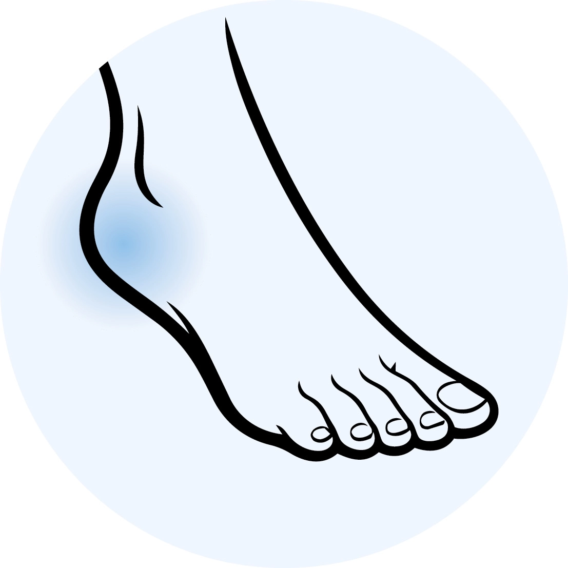 Shoes for plantar fasciitis